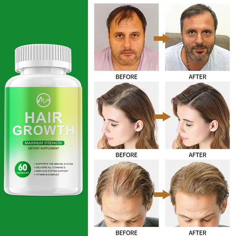 Hair Growth Vitamins 60 Capsules R242